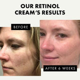 ORGANIC Retinol Cream for Face β Anti Wrinkle - toylibrary.lk